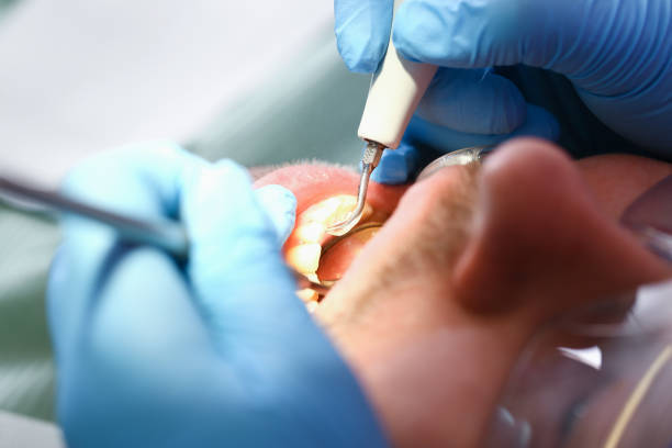 Best Emergency Dental Filling Replacement  in Dwight, IL