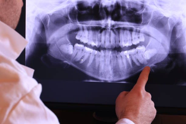 Best Cracked Tooth Emergency Dentist  in Dwight, IL