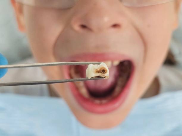 Best Urgent Tooth Repair  in Dwight, IL